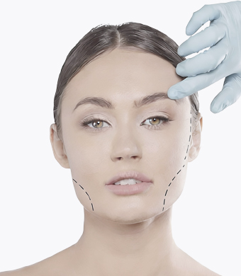 Реабилитация после подтяжки нитями Аптос