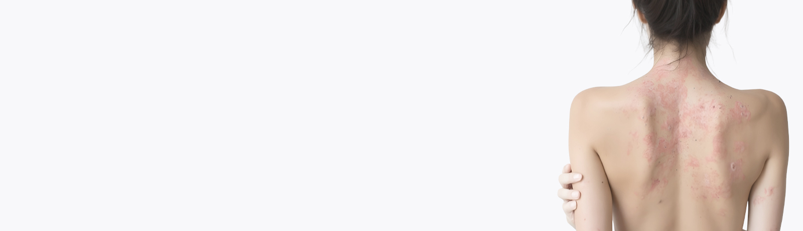 Болезни с сыпью